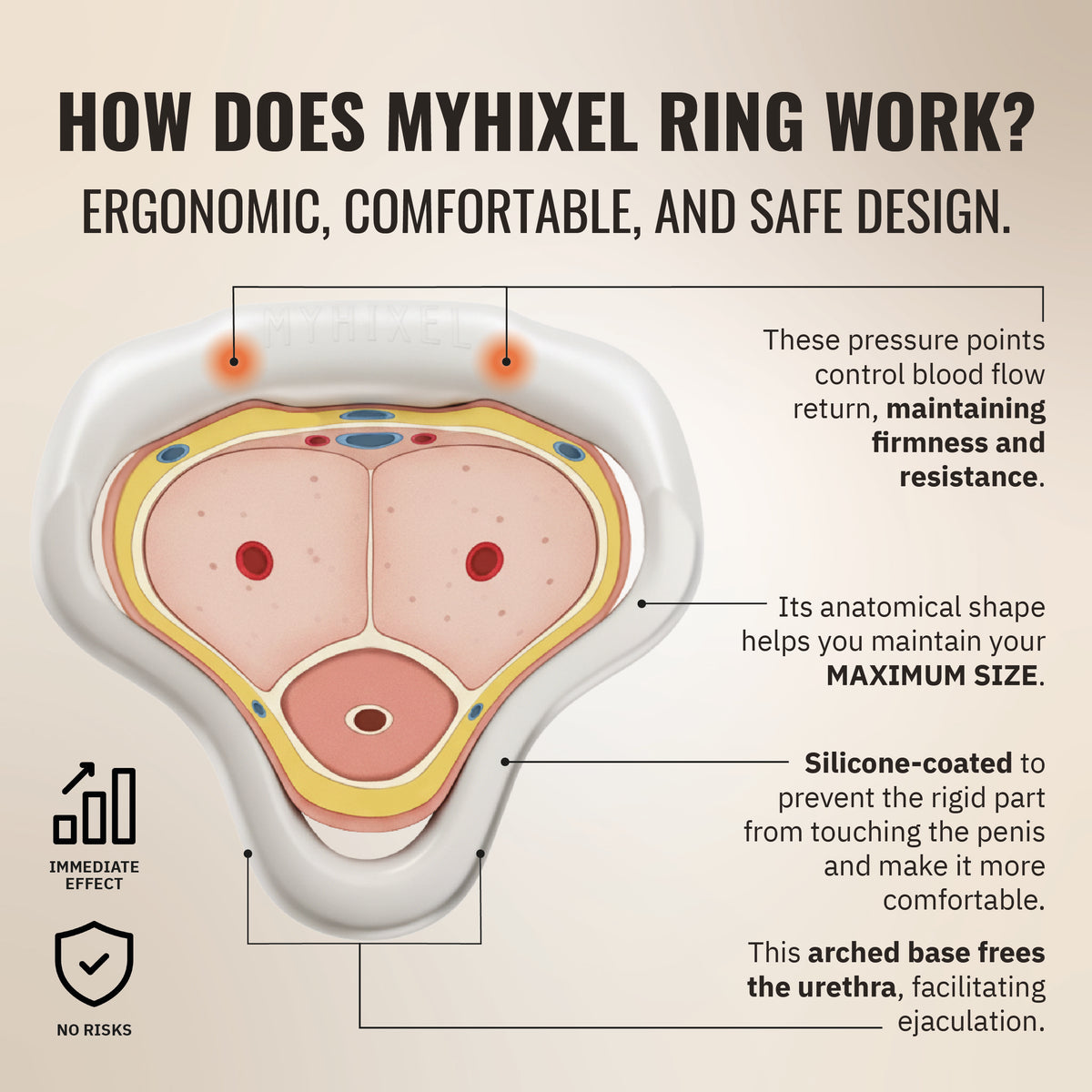 MYHIXEL Ring - Firm